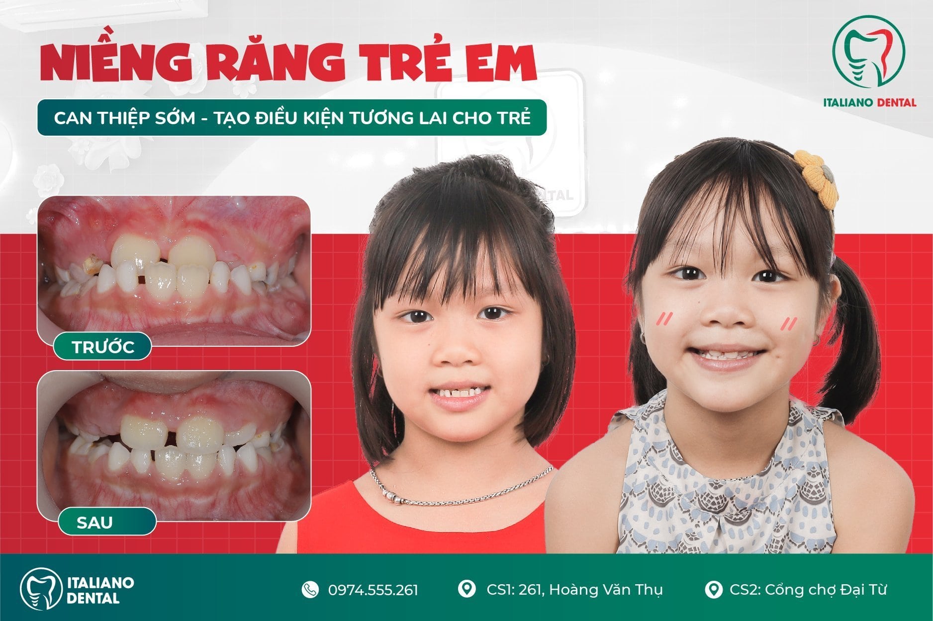 Bao nhiêu tuổi nên niềng răng Thái Nguyên?
