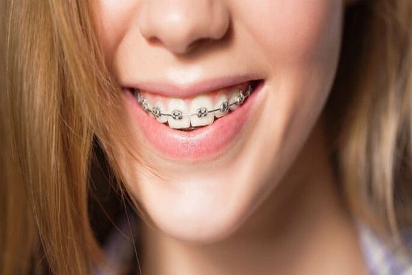 Răng móm là nguyên nhân gây các bệnh lý răng miệng