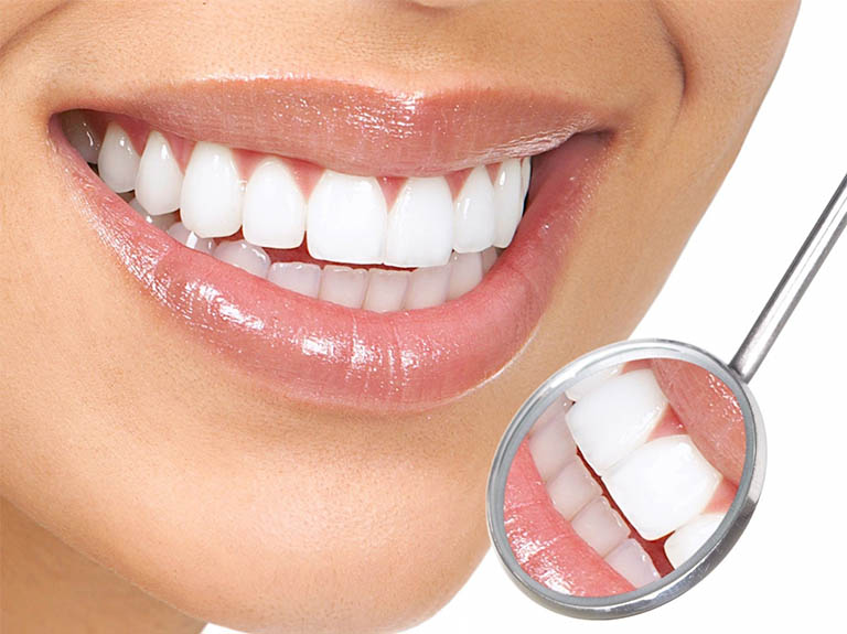 Răng tital có tốt không Thái Nguyên?