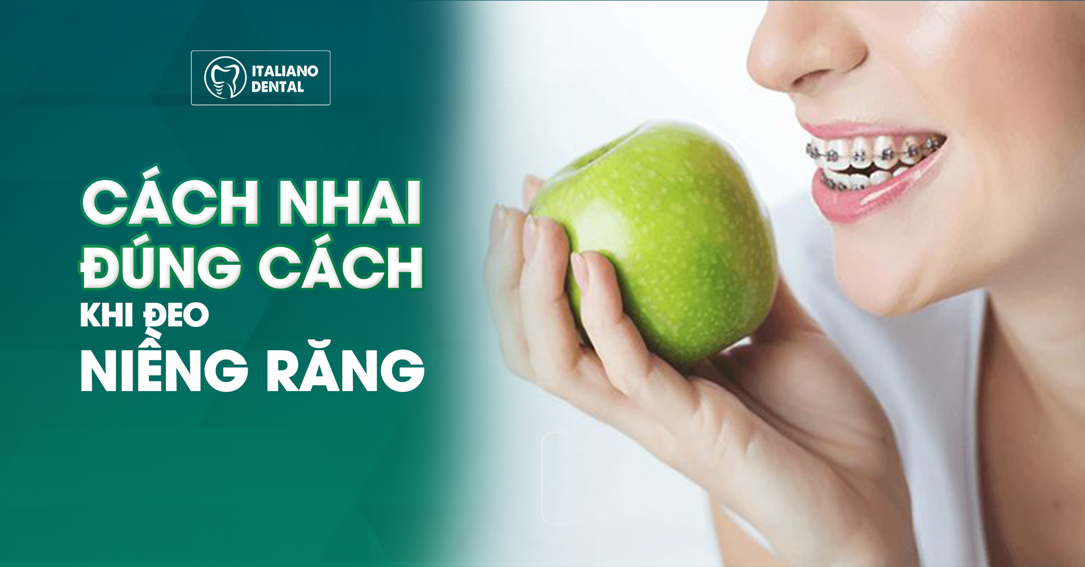 Hướng dẫn cách nhai đúng cách khi đeo niềng răng