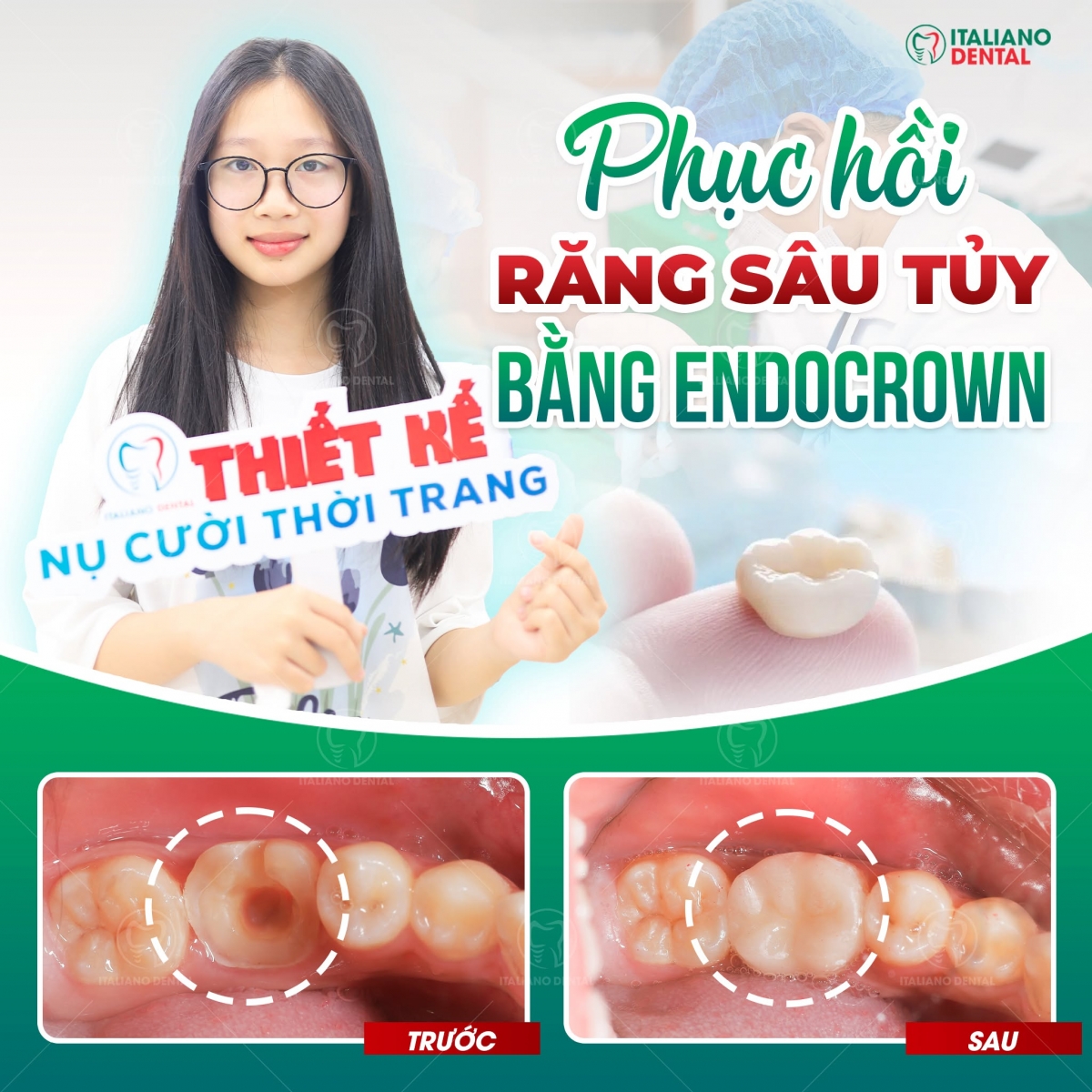 Điều trị răng sâu Thái Nguyên