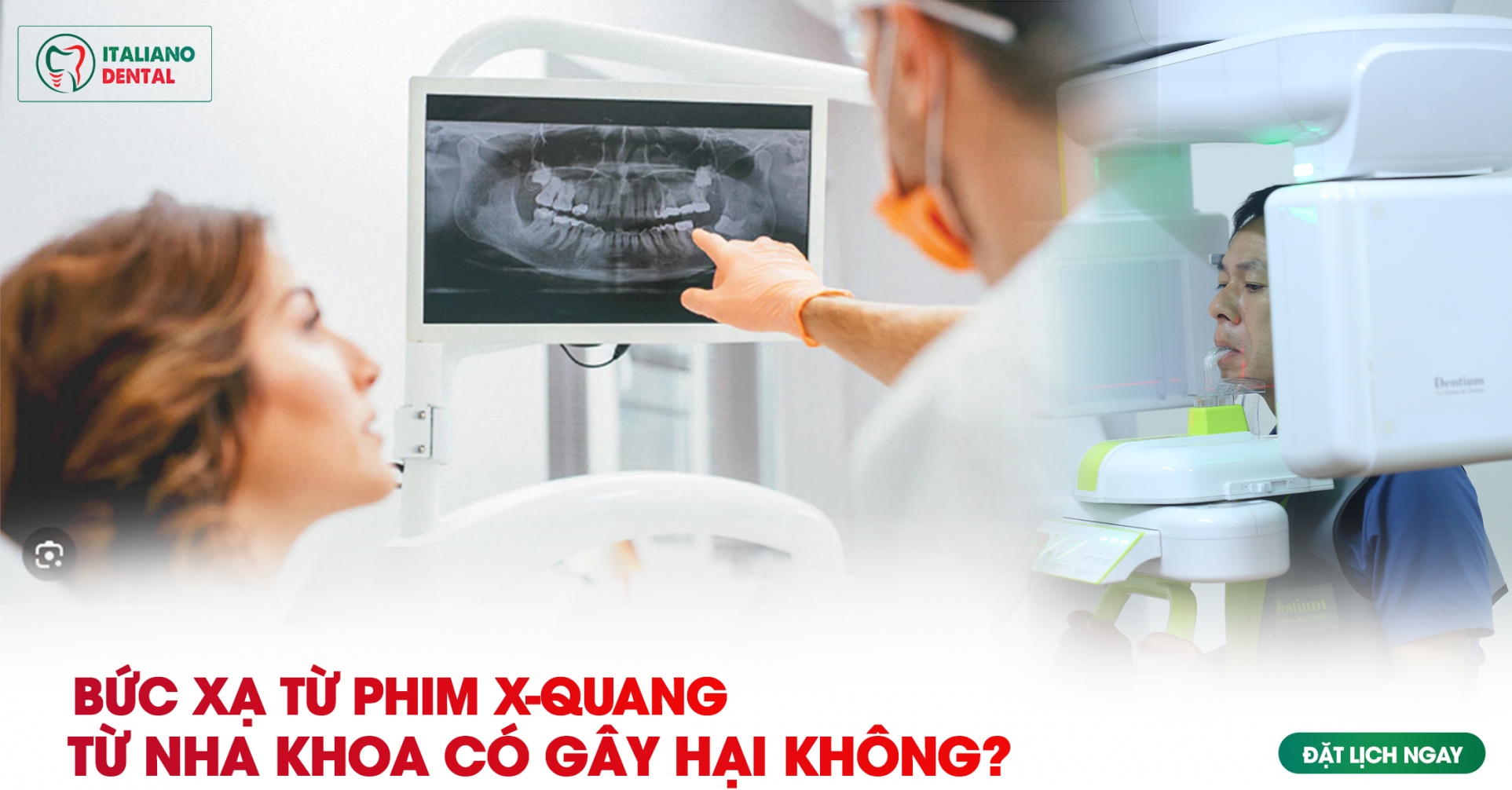 Bức xạ từ phim X- quang nha khoa có gây hại không?
