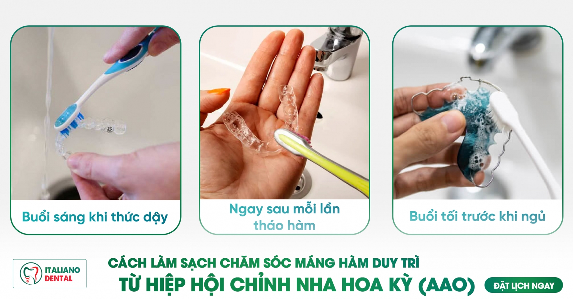 Cách làm sạch hàm duy trì: Hướng dẫn chăm sóc hàm duy trì từ Hiệp hội Chỉnh nha Hoa Kỳ (AAO)