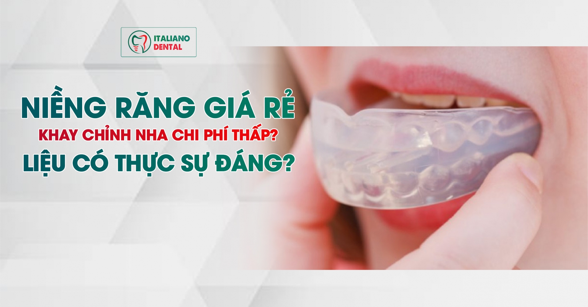 Niềng răng giá rẻ và khay chỉnh nha chi phí thấp- liệu có thực sự đáng không?