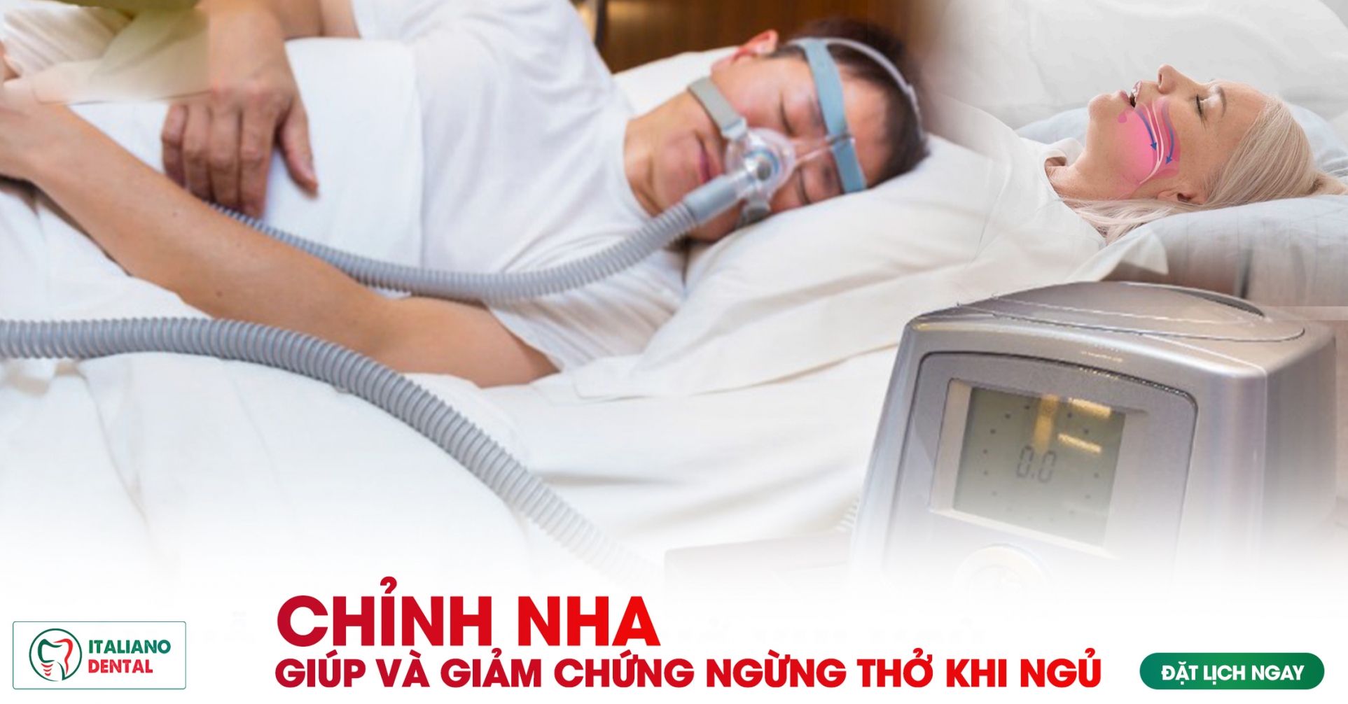 Cách chỉnh nha giúp cải thiện và giảm chứng ngừng thở khi ngủ