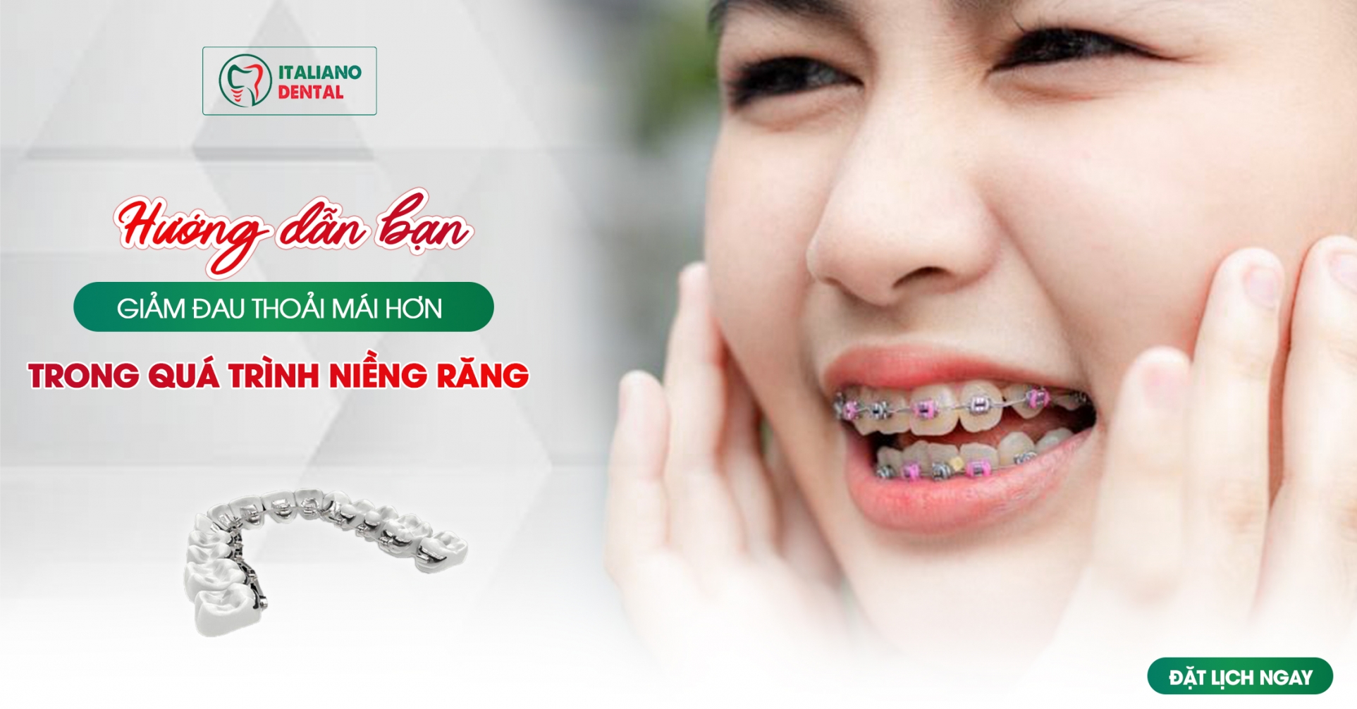 Hướng dẫn toàn diện giúp bạn giảm đau và thoải mái hơn trong quá trình chỉnh nha