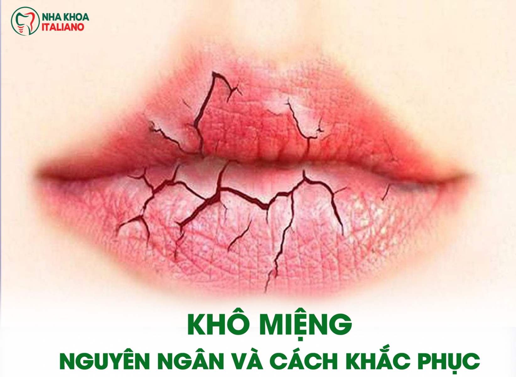 Bạn có đang bị khô miệng? Tìm hiểu nguyên nhân và cách khắc phục