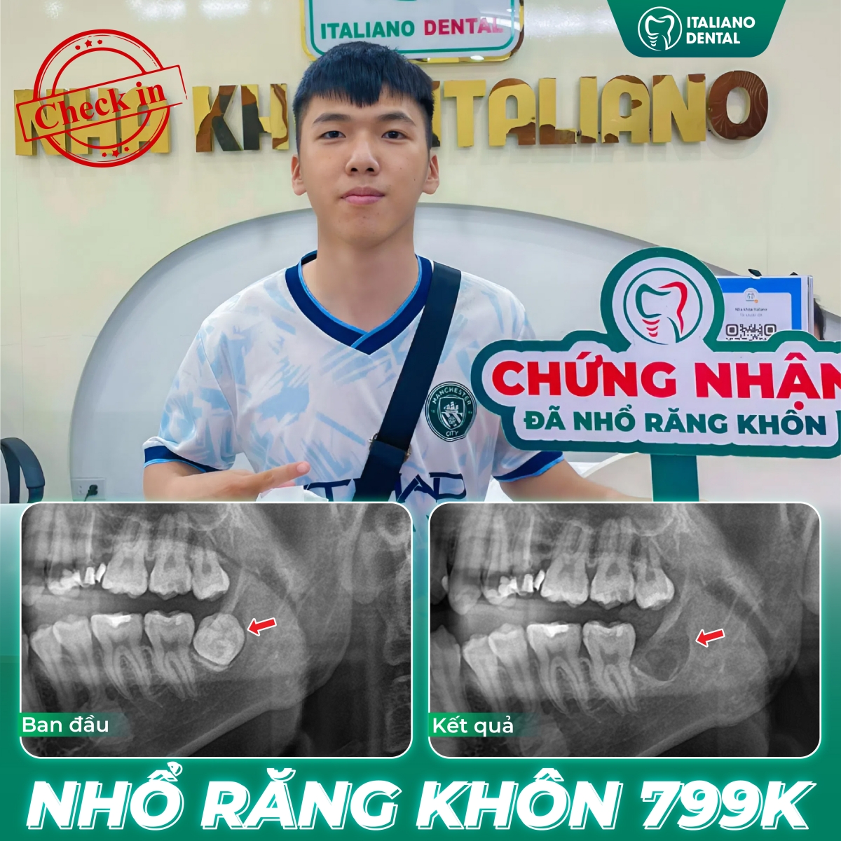 Mẹo giúp nhanh lành sau khi nhổ răng- Chia sẻ từ chuyên gia nha khoa Italiano