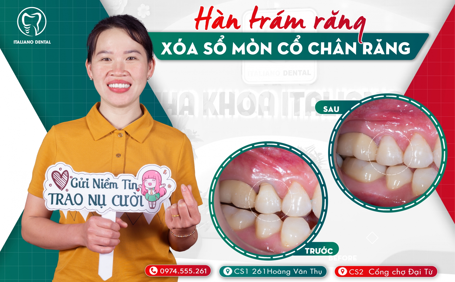 Bệnh mòn cổ chân răng có nguy hiểm hay không?