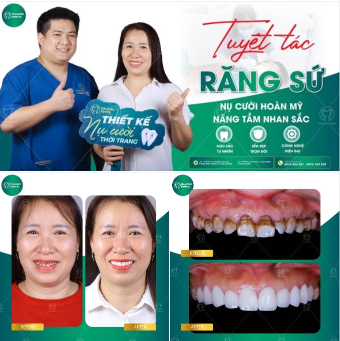 Sự thật về nha khoa thẩm mỹ – Những điều bạn cần biết trước khi làm đẹp răng