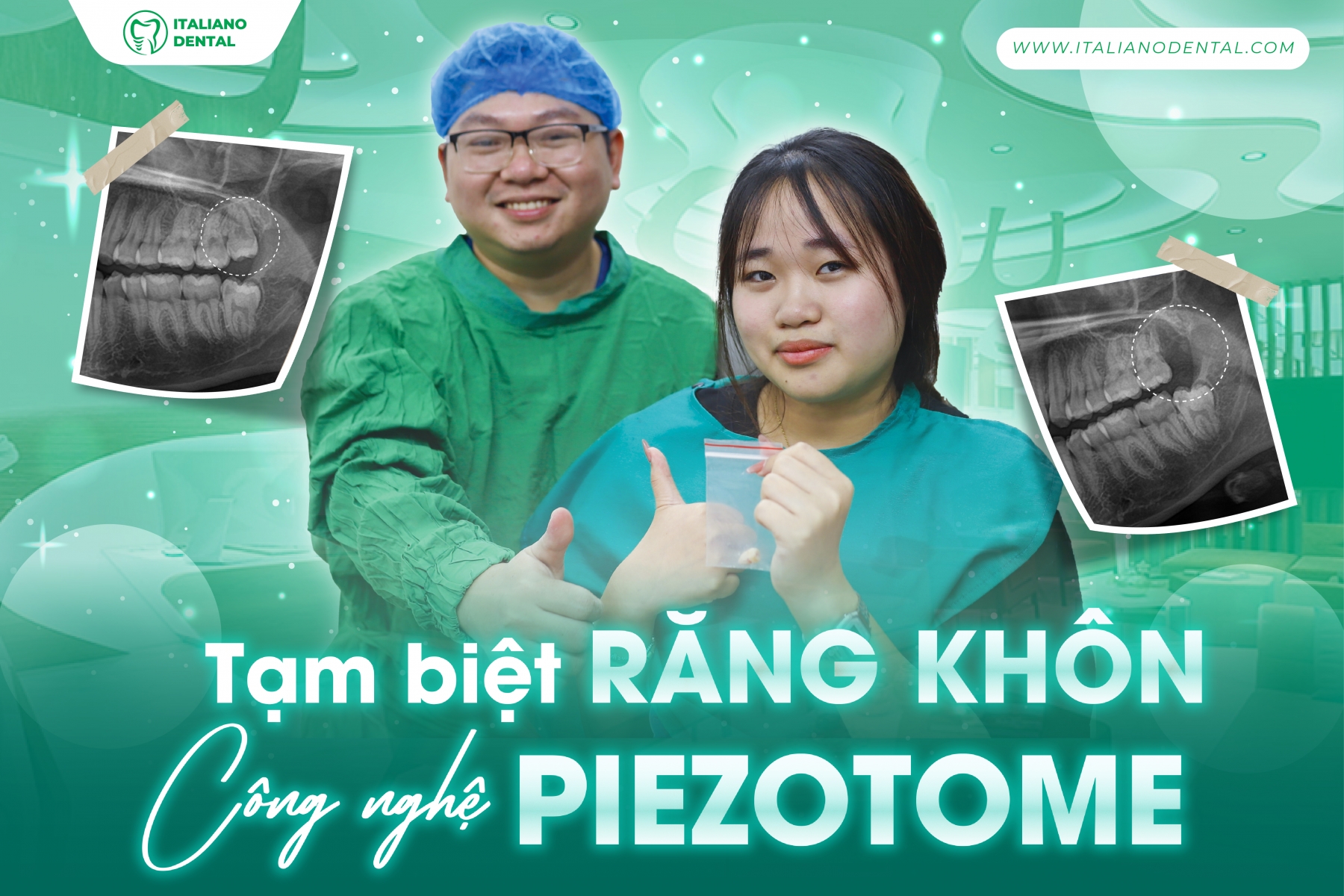 Nhổ răng 8 hàm trên có nguy hiểm không?