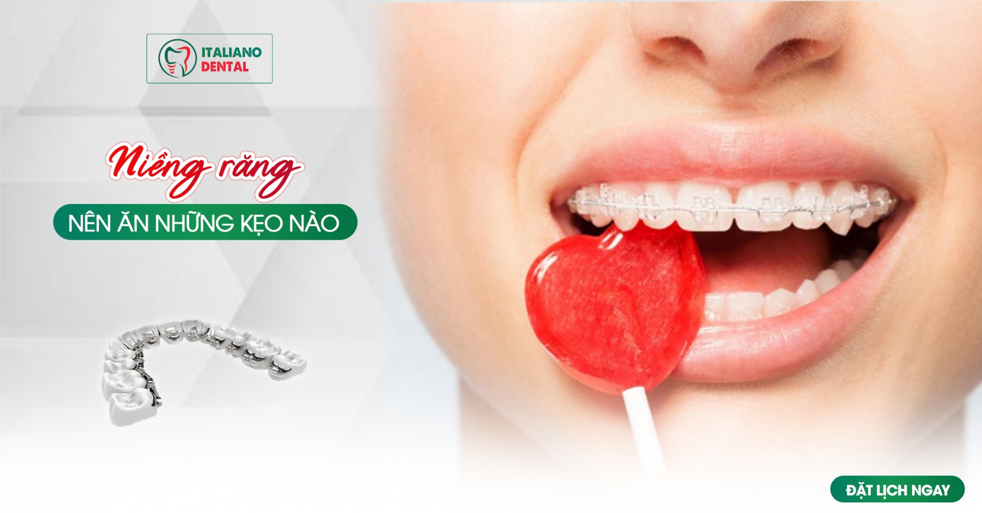 Khi niềng răng nên ăn những kẹo nào?