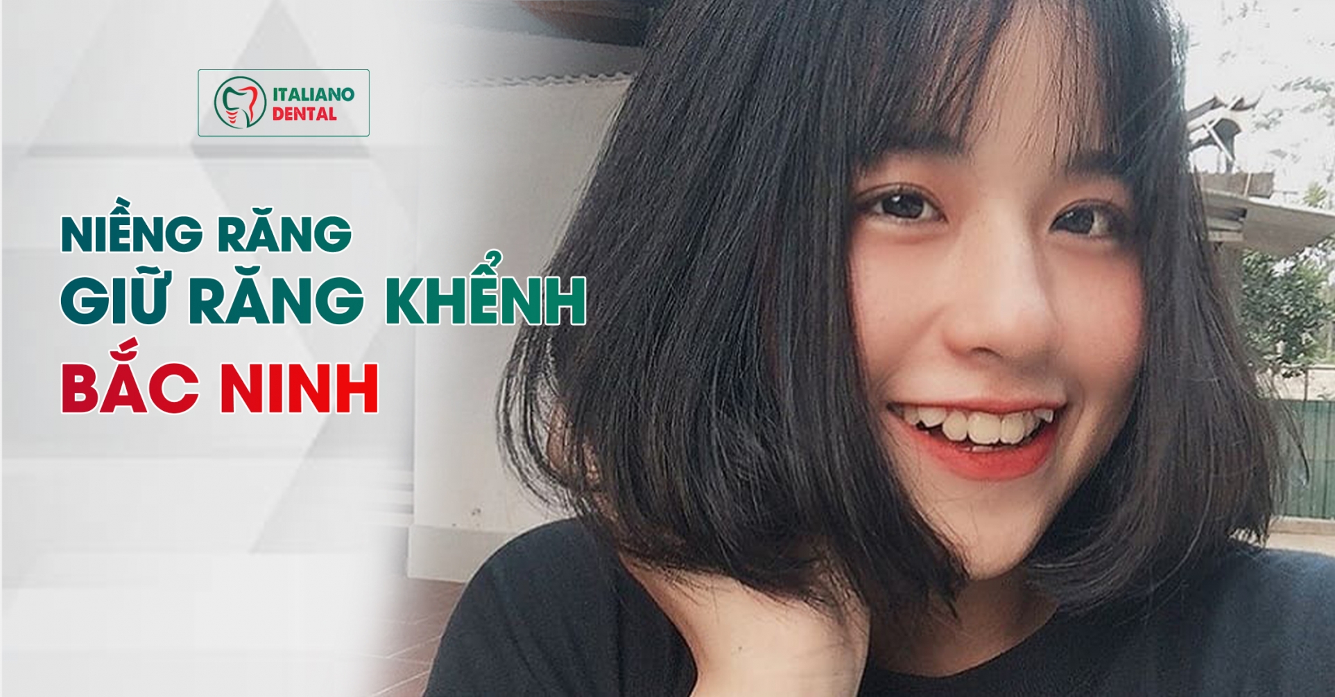 Niềng răng giữ răng khểnh Bắc Ninh