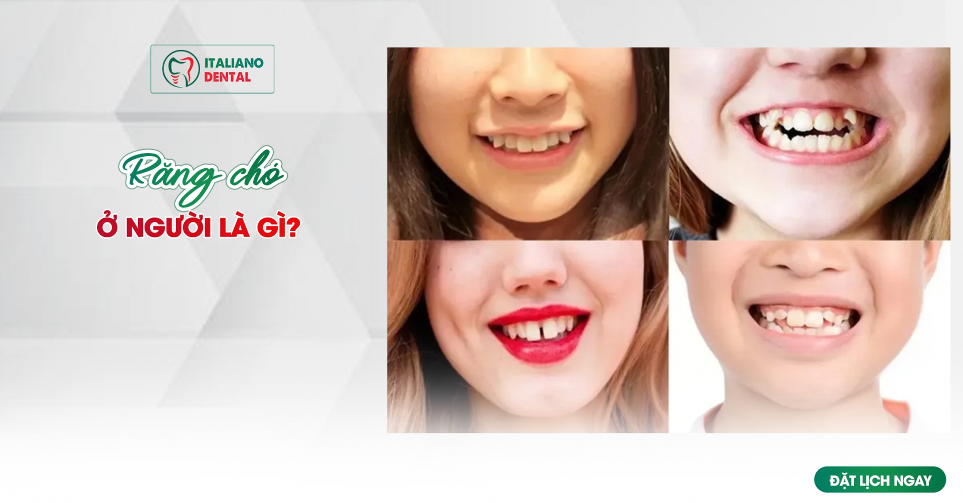 Răng chó ở người là gì?