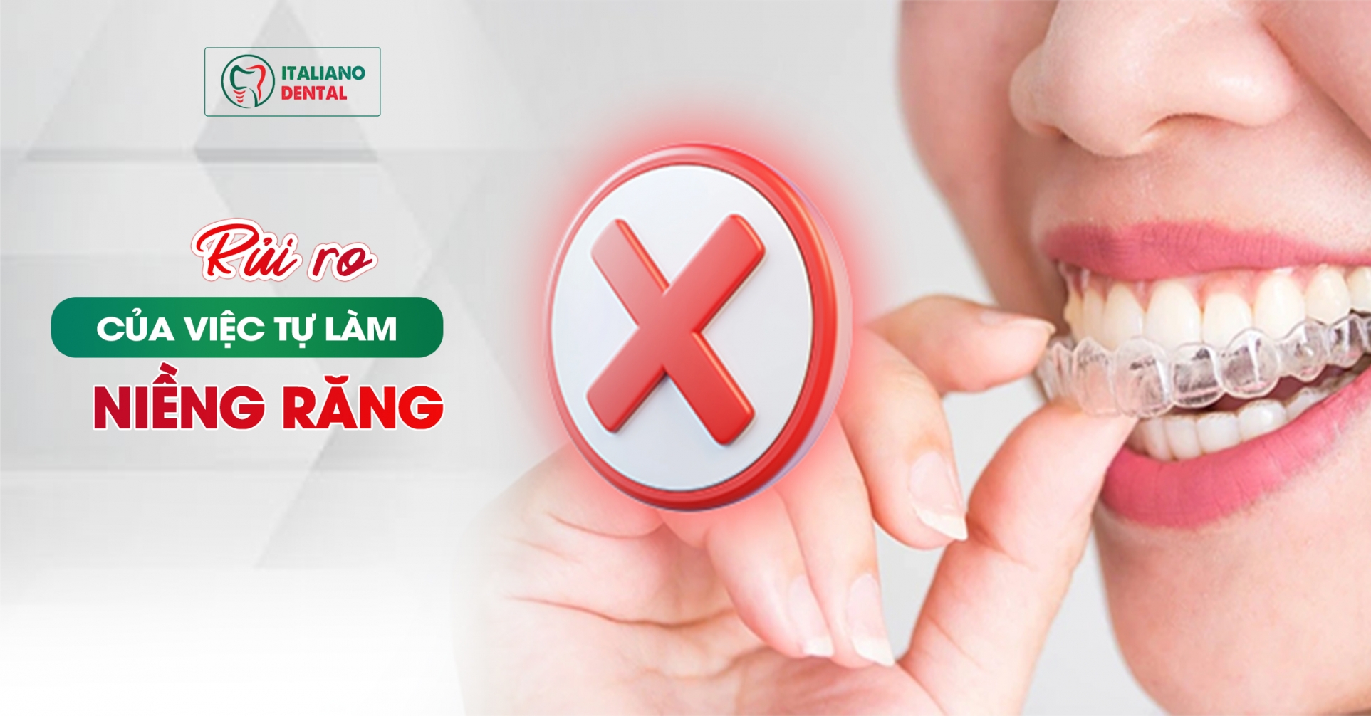 Rủi Ro của Việc Tự Làm Niềng Răng