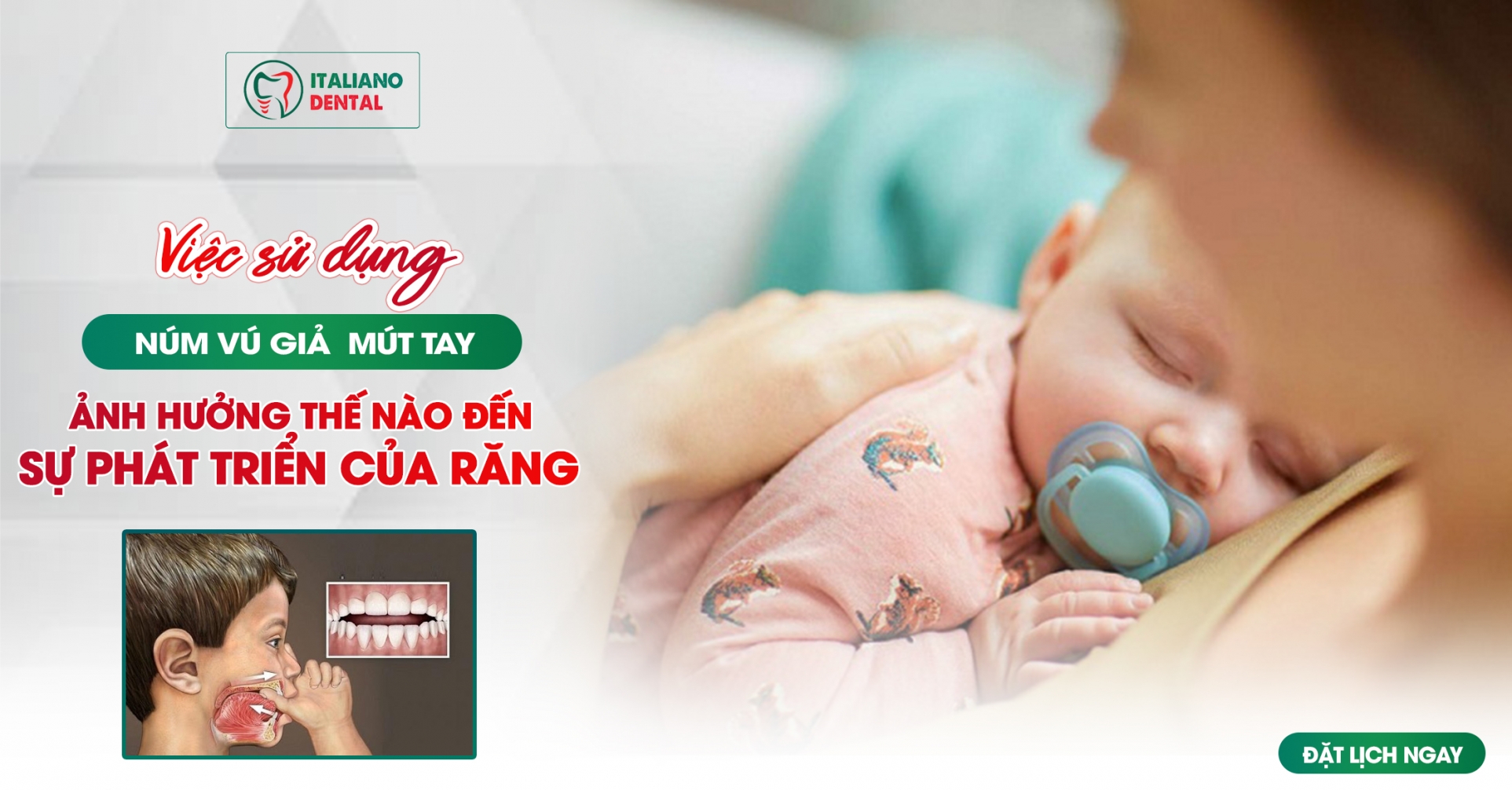 Việc sử dụng núm vú giả và mút tay ảnh hưởng thế nào đến sự phát triển của răng miệng