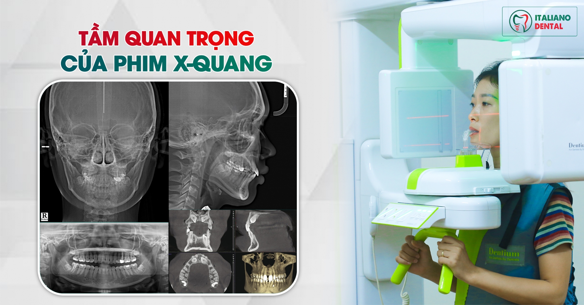 Tầm quan trọng của phim X-quang chỉnh nha: Hướng dẫn toàn diện
