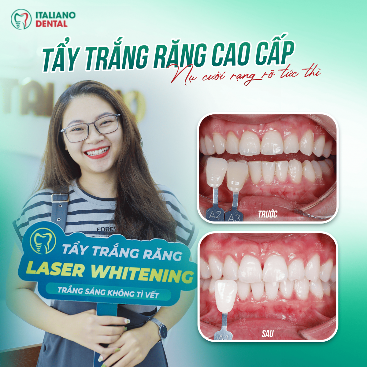 Tẩy trắng răng- cách làm trắng răng chuyên nghiệp
