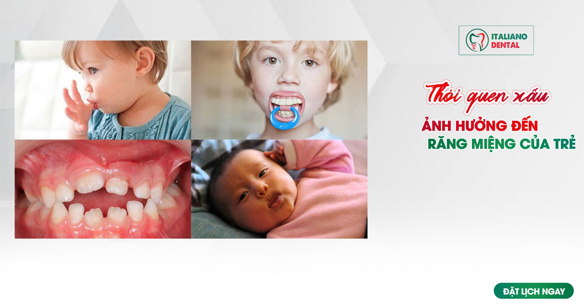 Những thói quen xấu ảnh hưởng đến sức khỏe răng miệng của trẻ