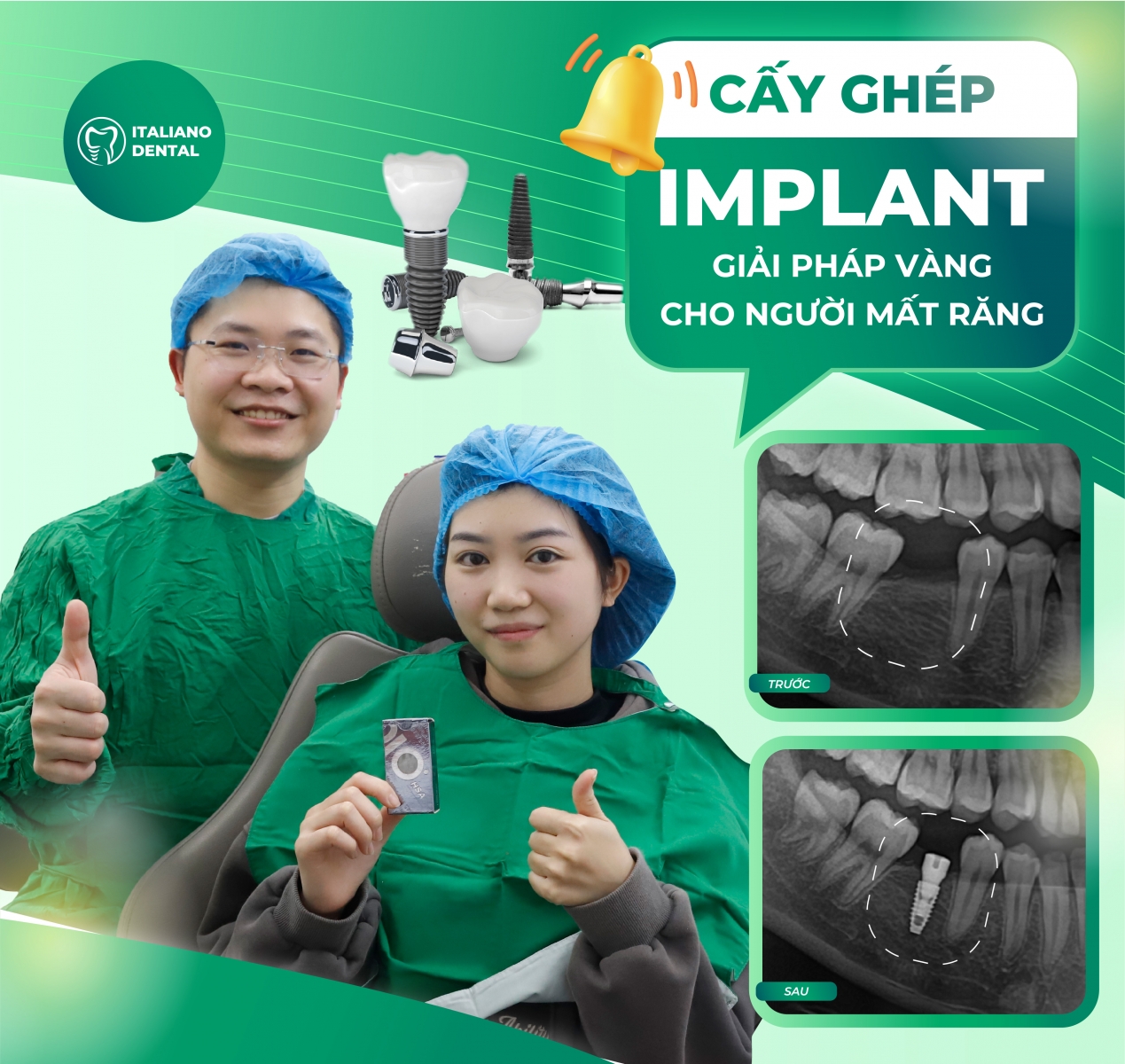 Trồng răng implant có độ bền không? Cách giúp duy trì tuổi thọ của răng implant