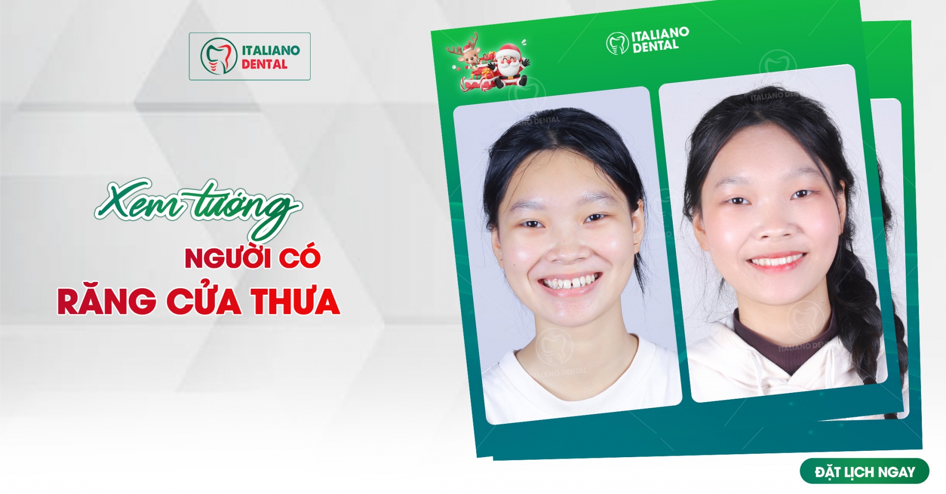 Xem tướng người răng cửa thưa