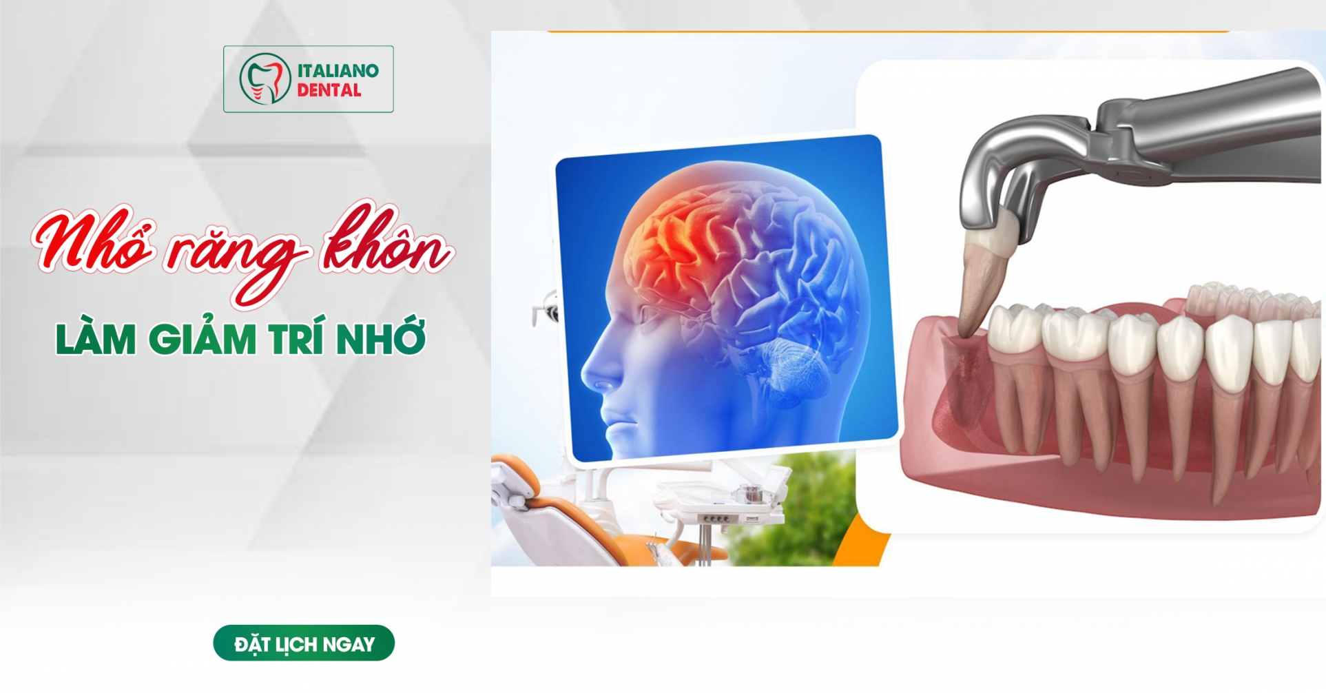 Nhổ răng khôn làm giảm trí nhớ?