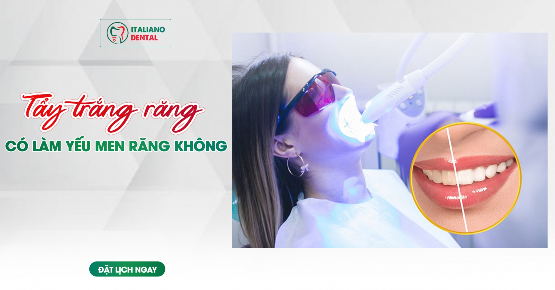 Tẩy trắng răng làm yếu men răng?